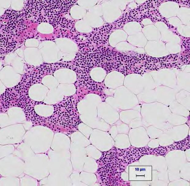 Parathyroid Glandular Epithelium Cord-like secretory cells and adipose tissue (A).