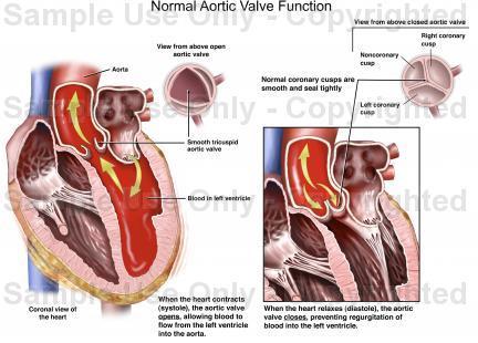 During the diastole the blood come back from the aorta to the left ventricle, (and