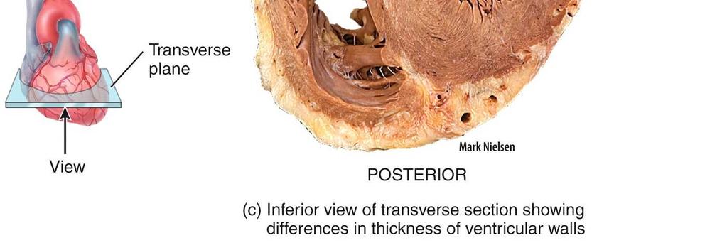 over the body The wall of the left ventricle is much thicker than that of the