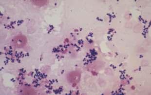 What is Staphylococcus aureus?