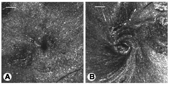 Ultrasound scanning microscopy: A) No rotation; B) Rotation Responses to Acupoint Stimulation 1.