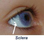 Layer Transparent tissue surrounding the sclera Protective layer Vascularized