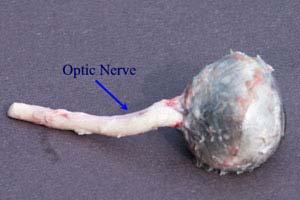 The optic nerve, also called Cranial Nerve II (CNII), transmits visual