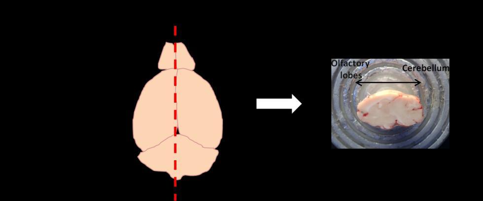 Figure 6.1 shows the sagittal orientation in a mouse brain. Rodent brains are analysed with MSI mainly because of their reduced size and their high content of lipids, which ionise easily [1], [5] [9].