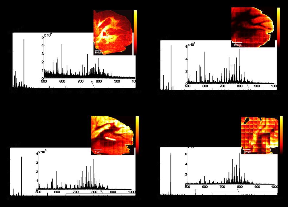 Figure 6.15: Total ion count (TIC) images and total ion spectra acquired from the cerebellar area of serial sagittal mouse brain sections. The primary ion dose applied was 1 x 10 12 ions cm -2.