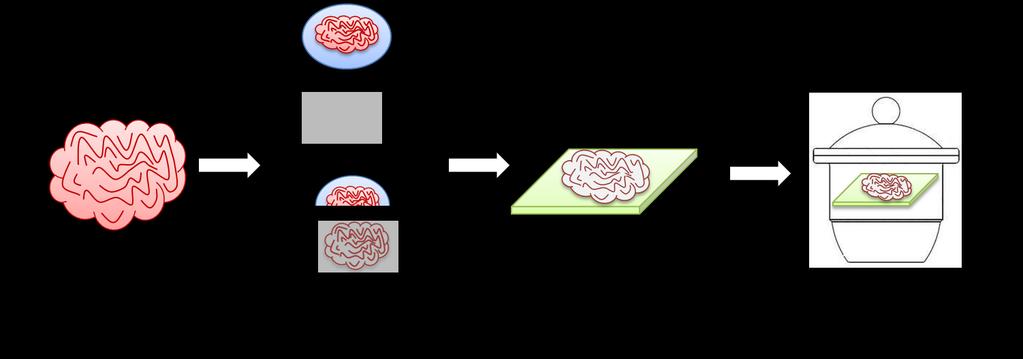 2.5.4 Sample preparation workflow for mouse brain imaging with ToF-SIMS Figure 2.22 illustrates the traditional sample preparation methodology for mouse brain. A complete brain ( ~ 0.