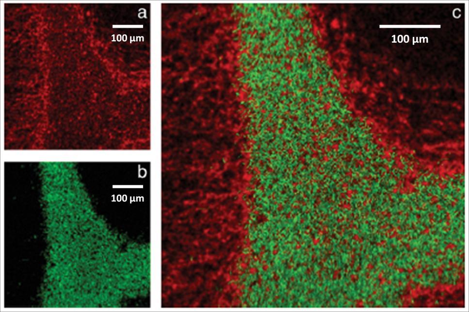 Figure 2.23: ToF-SIMS images in negative ion mode with added intensities of sulfatides from a mass range m/z 778.5-934.6 (a). (b) Distribution of cholesterol (m/z 385) in white matter in green.