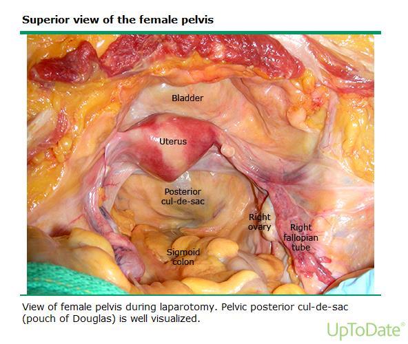 Pelvic organs are maintained in position by supporting ligaments, fascia