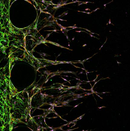 APPLICATION SPECIFIC PROTOCOL ANGIOGENESIS AIM 3D Cell Culture Chips offer a new perspective in studying angiogenesis by allowing the growth of new vascular sprouts in a 3D matrix from a pre-existing