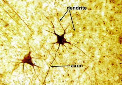 Neuron Multipolar Neuron https://www.youtube.com/watch?