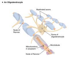 Schwann cell forms PNS myelin Multiple sclerosis patchy loss of