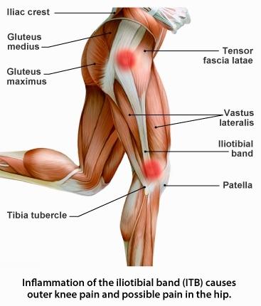 attach to the IT band before it crosses the lateral condyle of the femur. Under normal circumstances, nerve sensors embedded in the lateral condyle are stimulated by increased tension of the IT band.