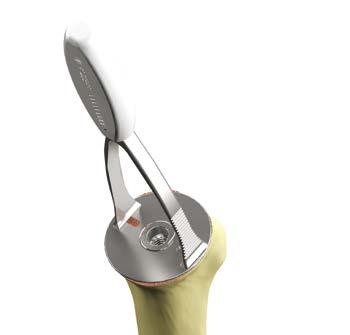 A cut protector can be attached to the fin blazer to protect the humeral cut surface from retractors during glenoid preparation.