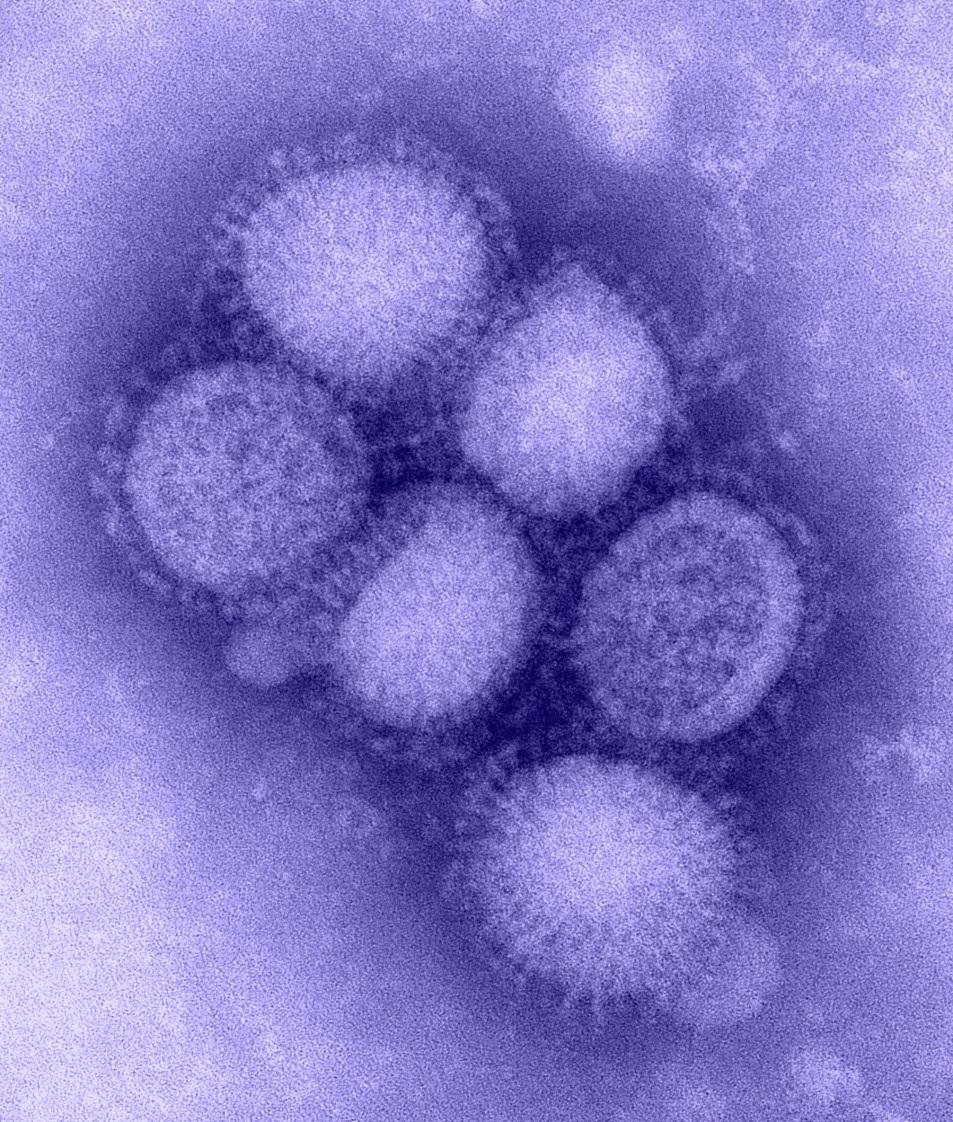 Other viruses Influenza a family of viruses that cause
