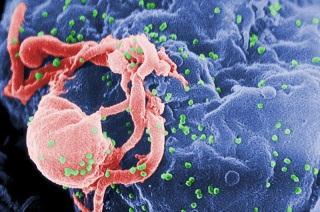 Human Immunodeficiency Virus The Virus that causes AIDS Crossed species barrier to humans in c.