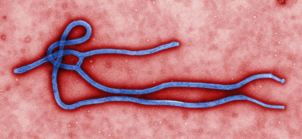 Ebola virus A gruesome kiler,