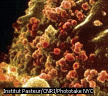 HIV virus infects T-cells HIV virus Weakens the immune system