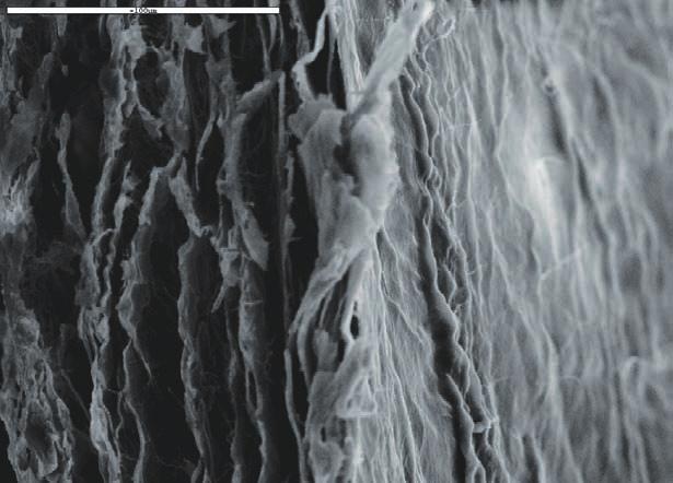 Returns to flat position when re-dried to allow re-fit to surgical site Smooth epitel barrier layer with multilayer collagen matrix for new blood vesicles growth* ~100µm SEM X 500 Edge showing dense