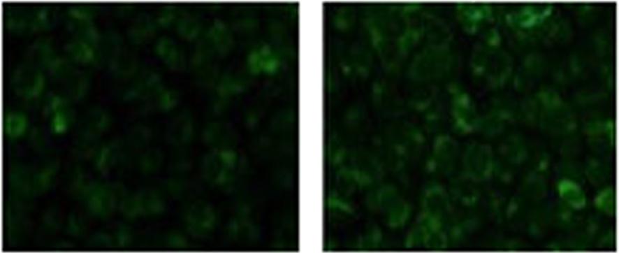 β-aescin in osteosarcoma cells 1585 MDC staining (Figure 5).