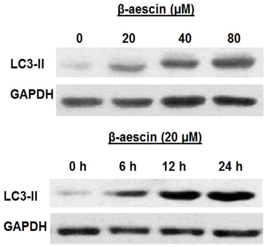 β-aescin enhances the expression of LC3-II in human Immunofluorescence was carried out for LC3- II to further investigate the generation of autophagic vesicles.