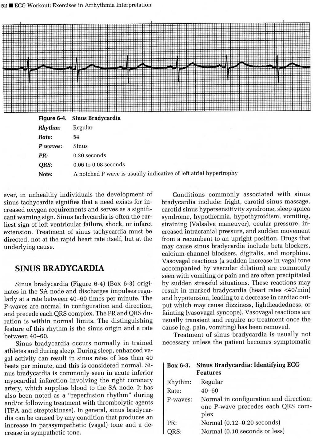 NSR: 8 Steps 1. P wave: upright, rounded n All p waves similar in size and shape n A p wave exists for every QRS complex 3. Atrial rate: 60 to 100 beats per minute 4.