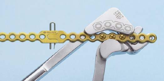 The plate can be cut to length, if necessary, using the plate and rod cutter. Alternative instrument 391.967* Shortcut Plate Cutter (2 required) As an alternative, shortcut plate cutters may be used.