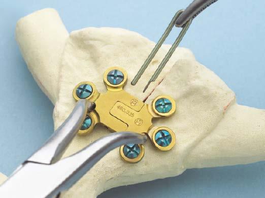Precautions: Bend the flat prong on the pin medially 20 25, to reduce the chance of pin