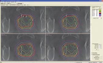 brachytherapy planning, simulation, and verification.