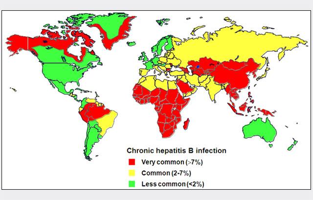 HBV Two billion worldwide have been infected with Hepatitis B 600,000 die annually secondary to Hep B HBV is more infectious than HIV Important occupational hazard It is preventable with vaccination!