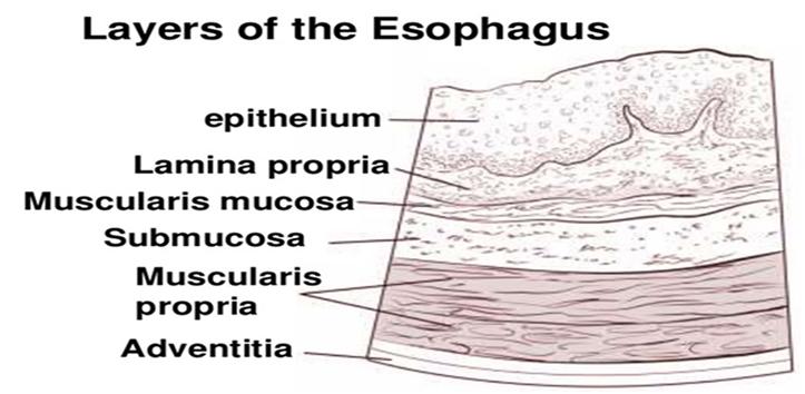 gov/types/esophageal Background The wall of the