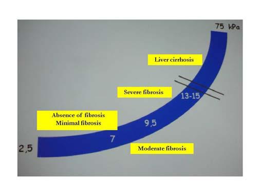 Estimation of liver stiffness 27.07.2010 11:47 6 Figure 4 Correlation between liver fibrosis and TE measurements.