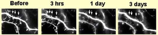morphine reduce # of dendrites in dopamine neurons Normal