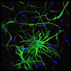 Astrocytes: hold neurons together
