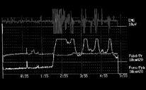 Pves [cmh2o] EMG SAE [uv] 620 ms cough not a simple spinal reflex.