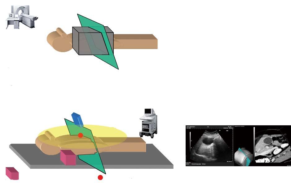 Pre-scanned computed tomography volume data are processed in the main body of the ultrasound machine.