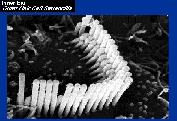 This is a electron micrograph of the top of a single outer hair cell The tallest cilia are connected to
