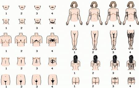 Signs & symptoms of Hirsutism androgen excess Htn Acne Tachycardia Oily skin Male body habitus Anovulation