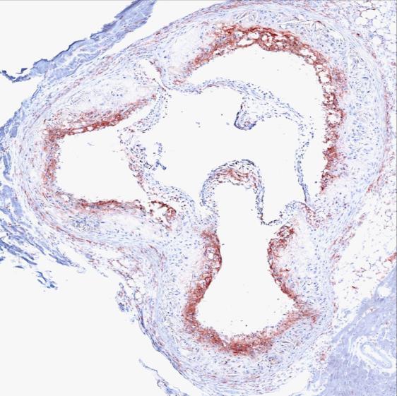 Ly-6C high monocytes (1 3 ) / aorta Plaque size (mm