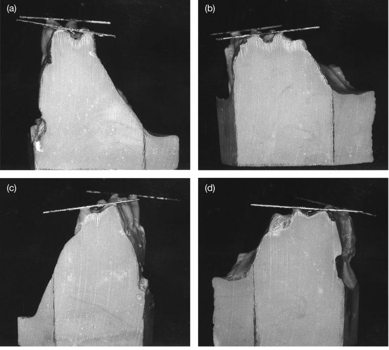 356 C.-H. CHUNG AND A. M. GOLDMAN Figure 4 Measurements of tipping of each first molar from pre- (T1) to post-expansion (T2).