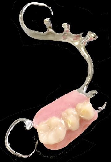 Dentures are made of either acrylic or metal (chrome) with acrylic.