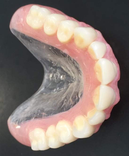 Additional Bolt-ons Available Our silver and gold denture options can be further customised by choosing some of the