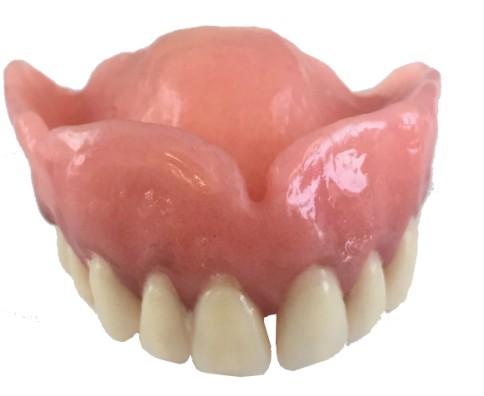 Gum/Flange Staining The acrylic gum part of dentures can be custom shaded to match your natural gum colour.