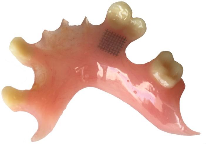 Individual Tooth Staining Individual permanent tooth staining is available on our gold option dentures.