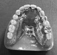 of the dental appliance (obligatory function)