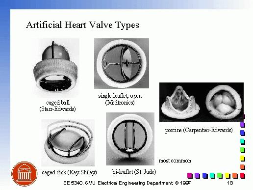 Heart Valves An estimated 78,000 people get replacement heart valves in