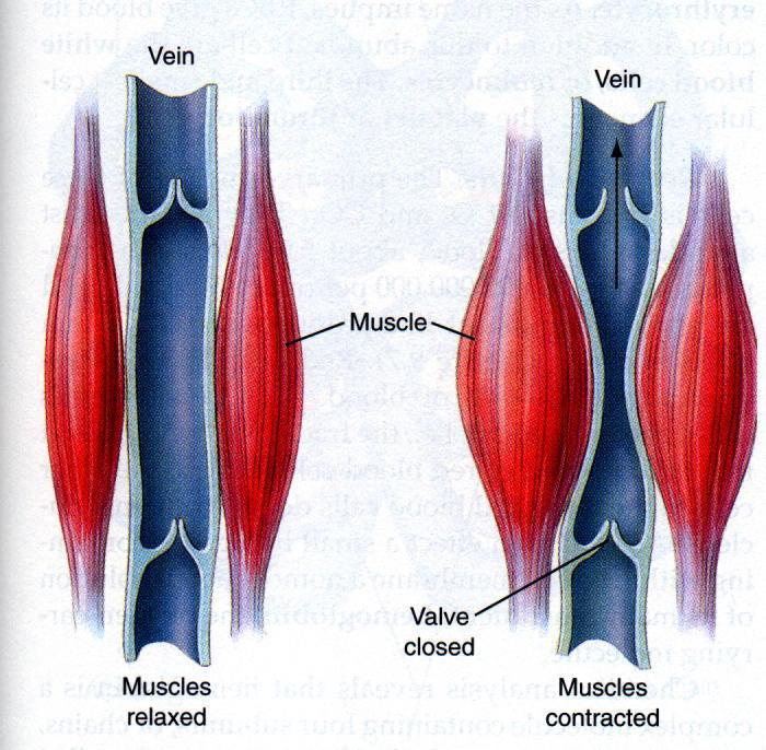 FUNCTIONAL VENOUS VALVES ARE REQUIRED FOR THE MUSCLE PUMP Varicosity In dilated, varicose veins valves fail Muscle pump is insufficient. EDEMA is frequent.