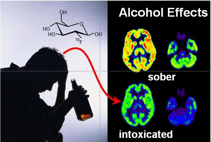 Imaging Alcohol s Effects on the Human Brain Glucose is the major energy source in the brain.