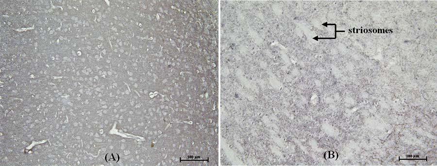 Fig. 3 Photomicrographs showing VGLUT2 immunoreactivity in (A) prefrontal cortex and (B) striatum (20x magnification) of control group. Fig.
