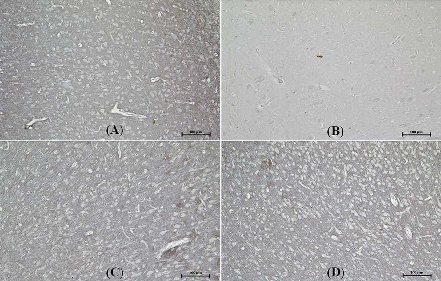 Fig. 11 Photomicrographs showing VGLUT2 immunoreactivity in prefrontal cortex of (A) control, (B) PCP administration, (C) PCP + Brahmi, and (D) Brahmi + PCP groups (20x magnification).