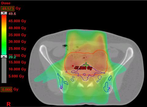 Impact of Functional Imaging on Active Bone